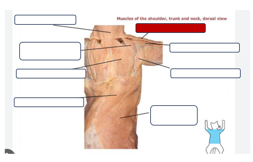 <p>Label the muscle</p>