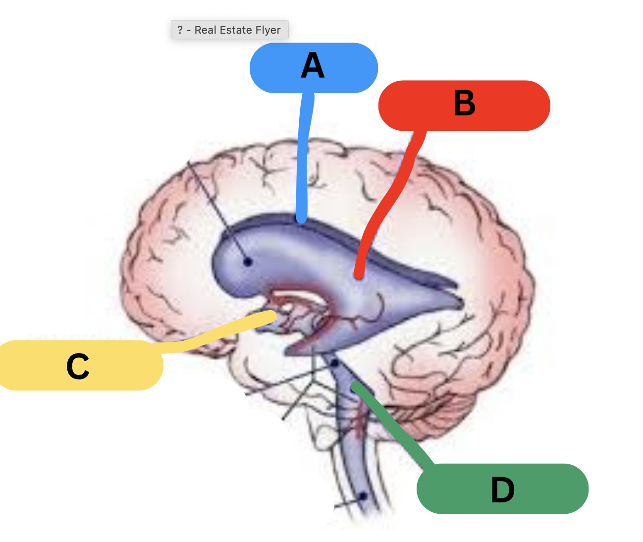<p>label the ventricles</p>