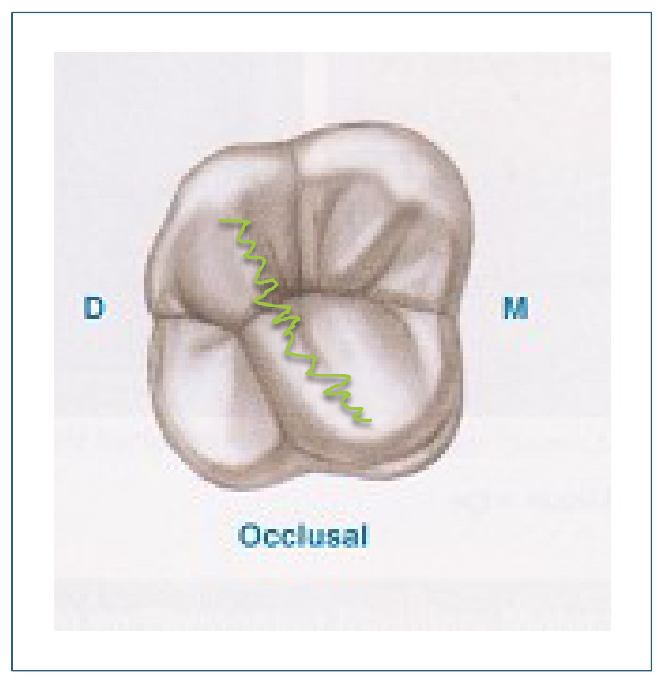 <p>squiggly line? 2 triangular ridges meet that are DB-ML</p>
