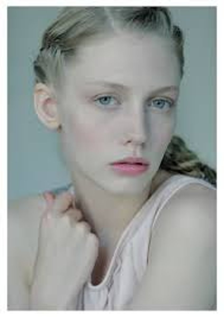 <p>Lack of hemoglobin (red pigment) --> low oxygen and pale skin</p>