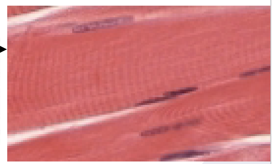 <p>Skeletal Muscle</p><p>Striated, Multinucleated, and Voluntary</p><p>attached to bones by tendons </p>