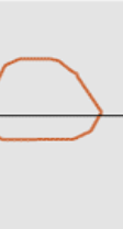 <p>what is this flow volume loop showing </p>