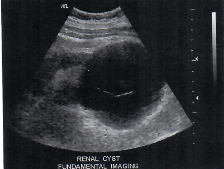 <p>This is an example of an image in which the scan lines do not orginate at a common ______</p>