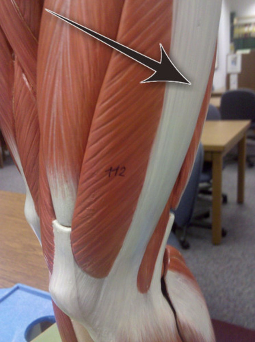 <p>on lateral edge of fascia lata</p>