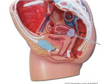 <p><span>Identify the highlighted structure</span></p>