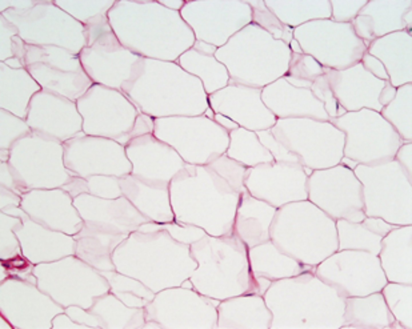 <p>tissue that stores fat</p><p>(think bubbles)</p>