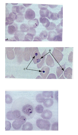 <p>What are morphology features of Plasmodium ring forms?</p>