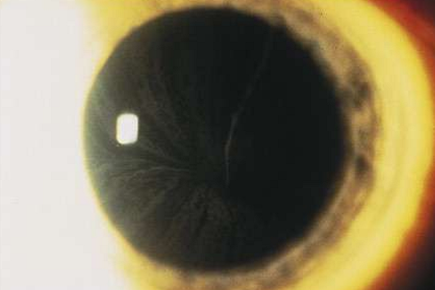 <p>What condition is this?</p>