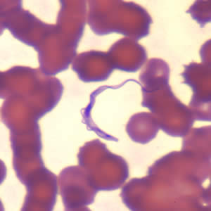 <p>Trypanosoma Brucei Gambiese: Blood Stream trypomastigotes</p>