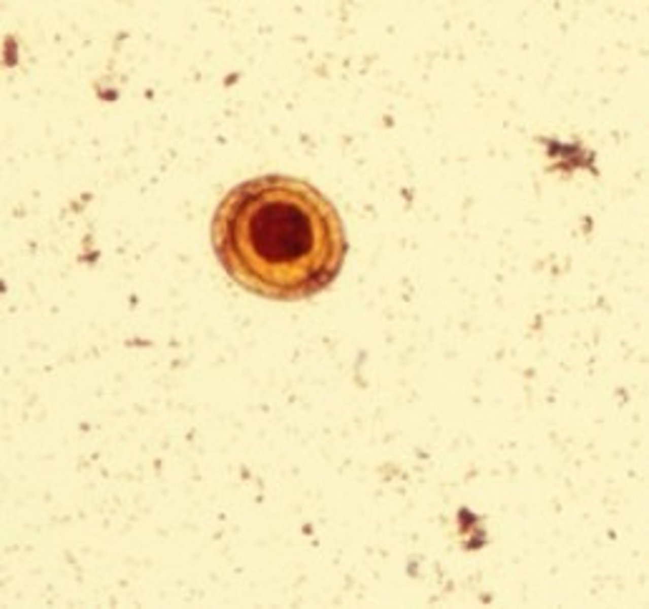 <p>Identify the parasite</p>