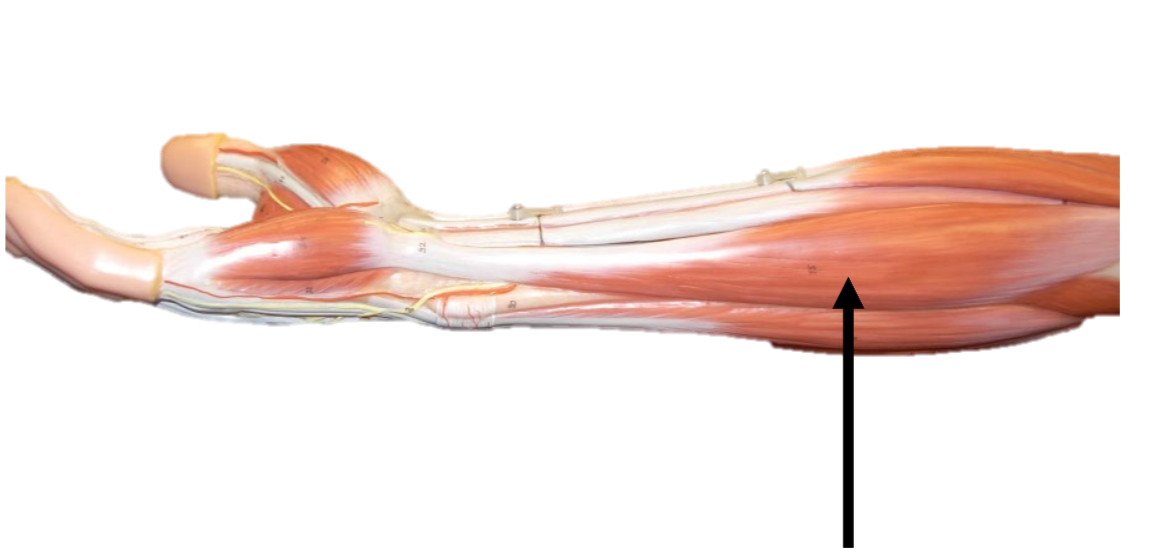 <p>Origin: medial epicondyle of humerus </p><p>Insertion: pisiform</p><p>Function: flexes hand at wrist</p>