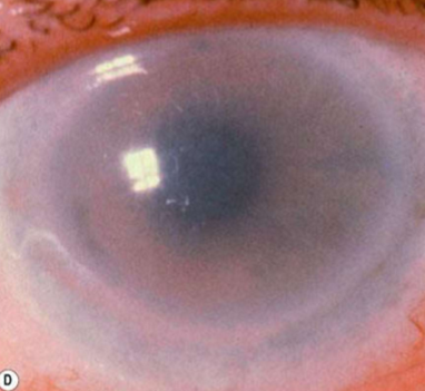 <p>What condition is this?</p>