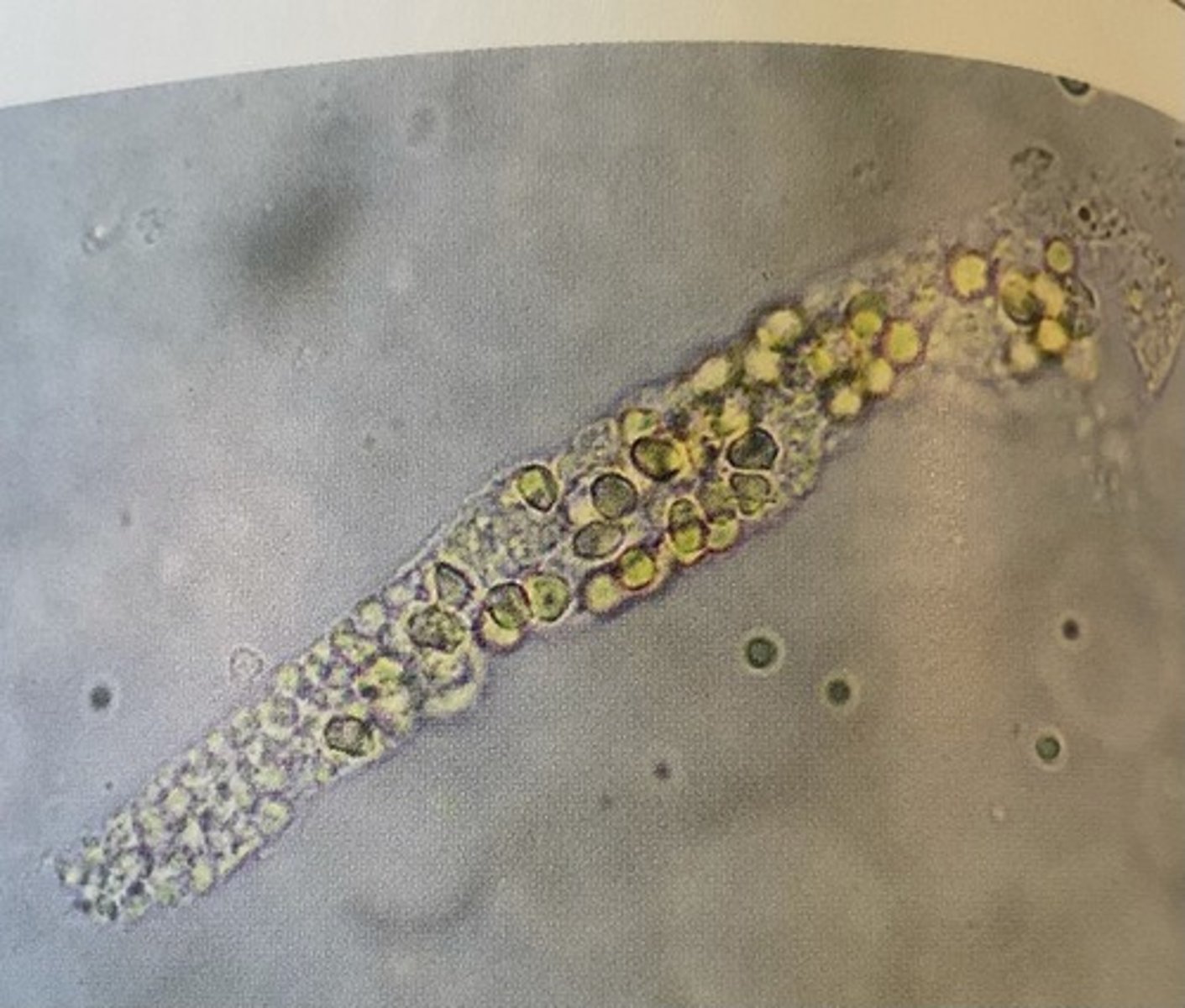 <p>What is being shown histologically?</p>