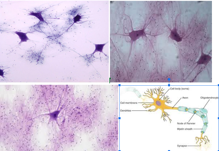 <ul><li><p>Characteristic: Made of <strong>NEURONS and NEUROGLIAL CELLS. </strong>There’s a <strong>CELL BODY, DENDRITE, and AXON</strong>. </p></li><li><p>Location:<strong> BRAIN AND SPINAL CORD</strong> </p></li><li><p>Function: <strong>TRANSMIT ELECTRICAL SIGNALS</strong> for the brain and body to process certain things </p></li></ul><p></p>