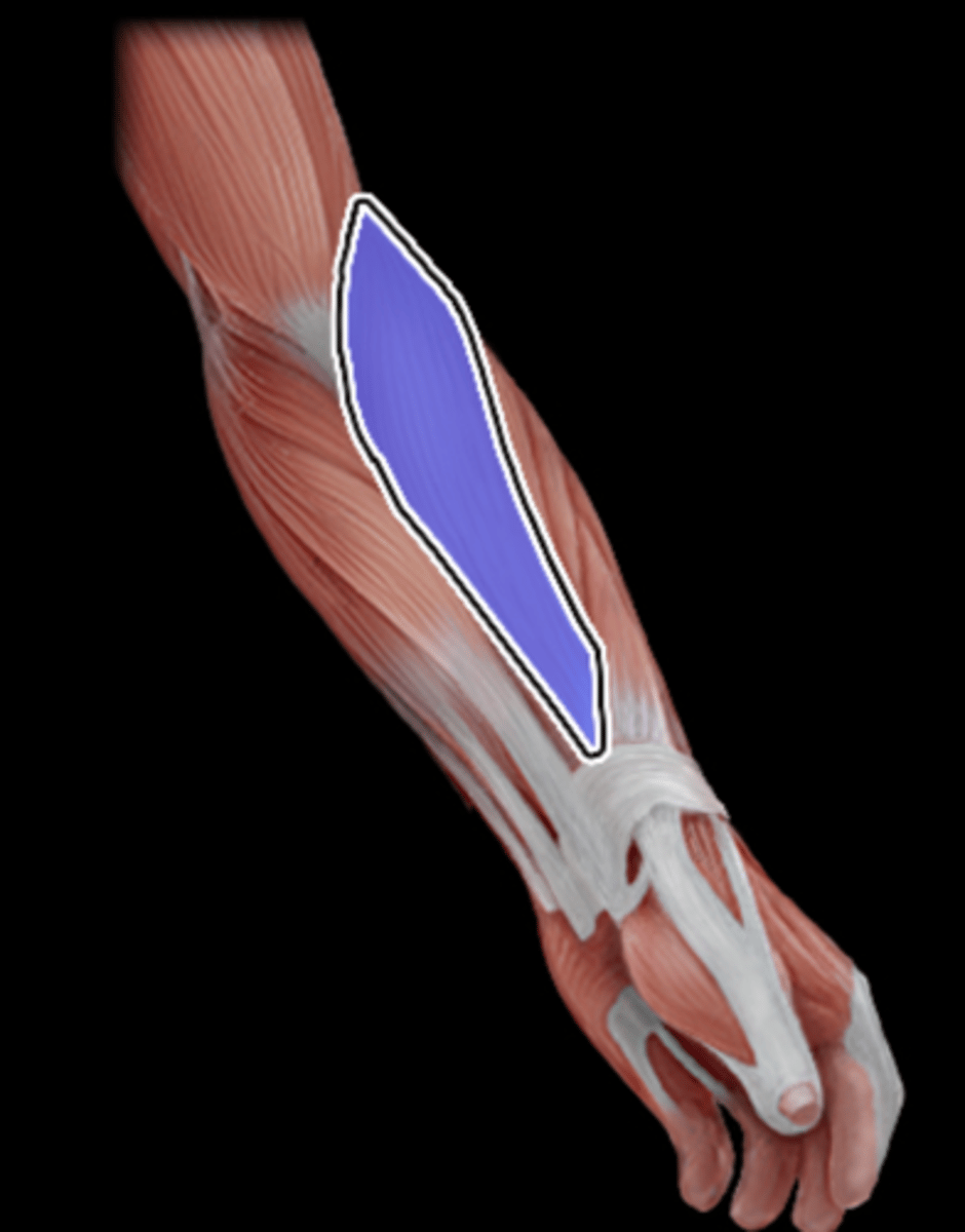 <p>What Muscle Is Highlighted?</p>