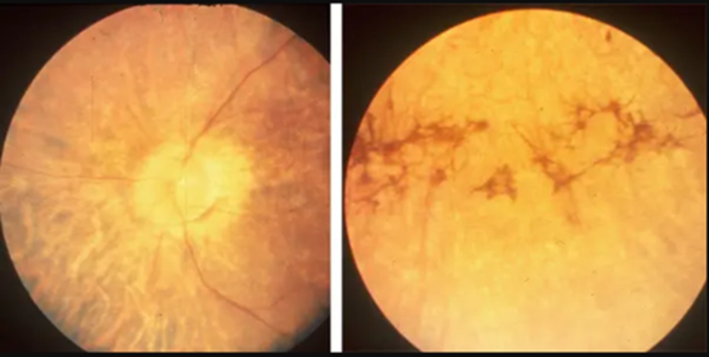 <p>blood work for cholesterol/TAGs/fat-soluble vitamins, acanthocytes</p>
