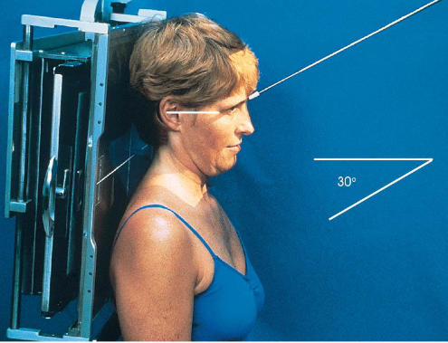 <ul><li><p>patient position:</p><ul><li><p>upright or supine</p></li></ul></li><li><p>part position:</p><ul><li><p>MSP perpendicular to midline</p></li><li><p>OML perpendicular to IR</p><ul><li><p>may use IOML if patient can’t flex neck enough</p><ul><li><p>increase in CR angle</p></li></ul></li></ul></li></ul></li><li><p>respiration suspended</p></li><li><p>CR:</p><ul><li><p>OML: 30 degrees caudad, enters glabella 1 inch above the nasion</p></li><li><p>IOML: 37 degrees caudad</p></li></ul></li><li><p>collimation:</p><ul><li><p>1 inch beyond the lateral sides of the face, superiorly to the top of the forehead, and inferiorly to the chin</p></li></ul></li></ul><p></p>