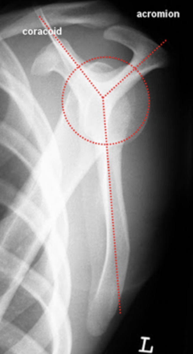 <p>The scapular Y view is orthogonal (perpendicular) to the AP shoulder view, used to assess suspected dislocations and fractures of the scapula by showing the coracoid and acromion process in profile.</p><p>RECALCO... good for</p><p>1) suspected dislocations/ fractures</p><p>2) evaluation of coracoid process and acromion</p>
