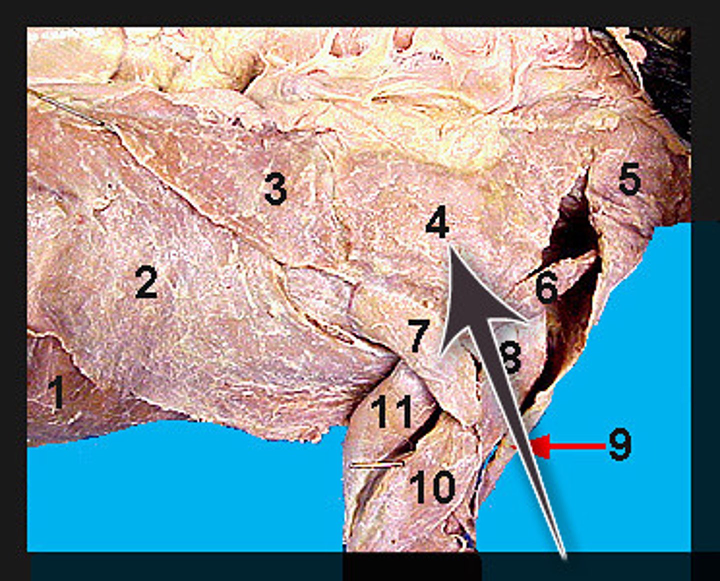 <p>Identify what the brown arrow is pointing to; also labeled number "4"</p>