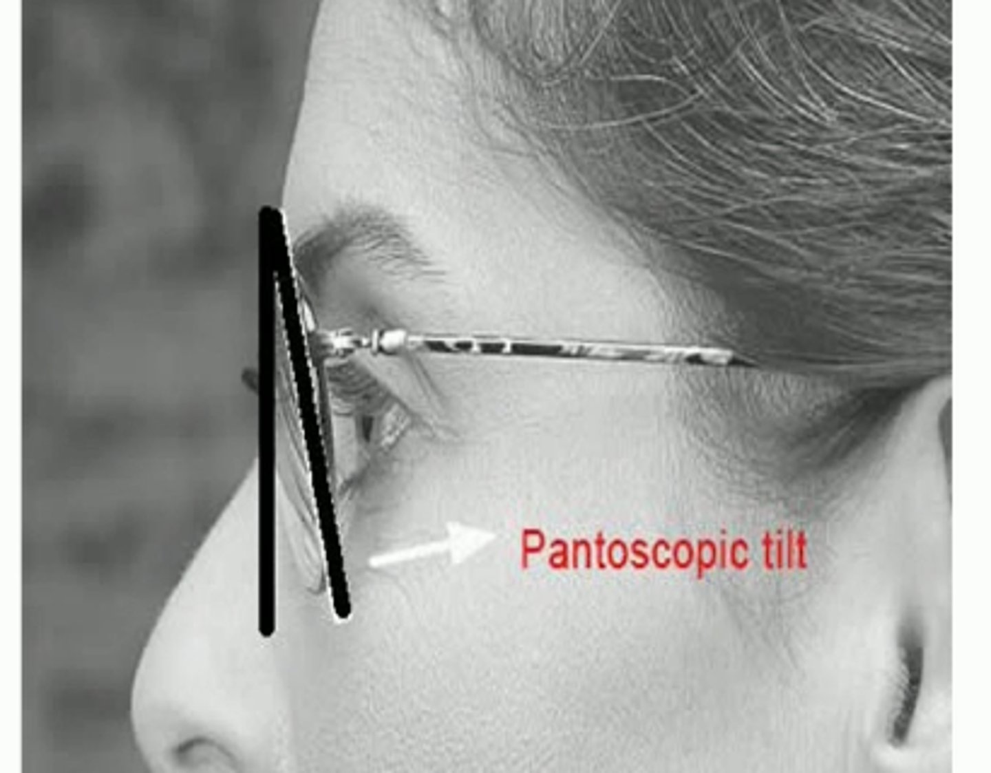 <p>The angle of an eyeglass lens in relation to the vertical plane</p>
