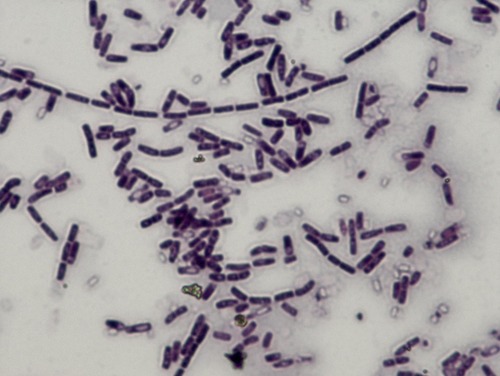 *Gram positive*, bacillus morphology, can *produce endospores*, bacillus subtilis - model organism, bacillus anthracis - anthrax, found in soil