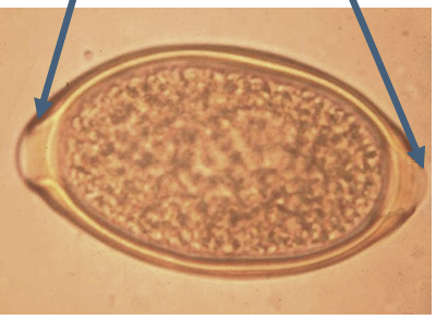 <p>similar to trichuris but bipolar plugs are assymetrical</p><p>can determine genus based on appearance of surface of shell wall</p>