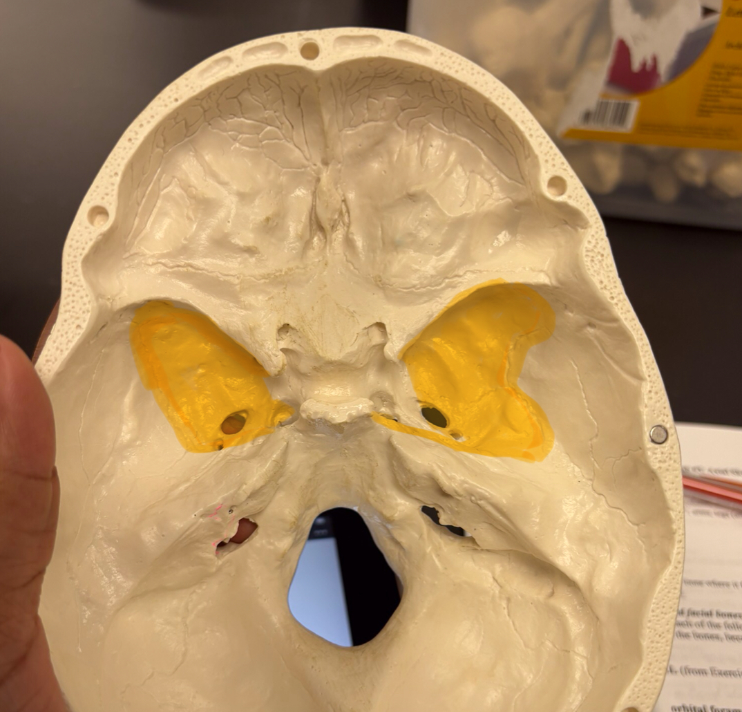 <p>-background of sella turcica</p><p>forms part of floor of cranial cav, contains many foramina</p>