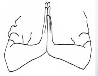 <p>Neuro: Reverse Phalen’s Test</p>