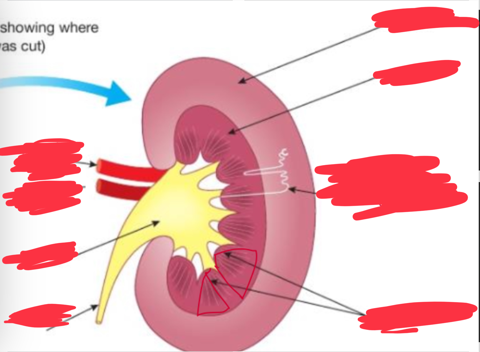 <p>Label the parts of the kidney + what are the 6 parts of a kidney</p>