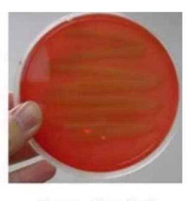 <p>What hemolysis is this</p>