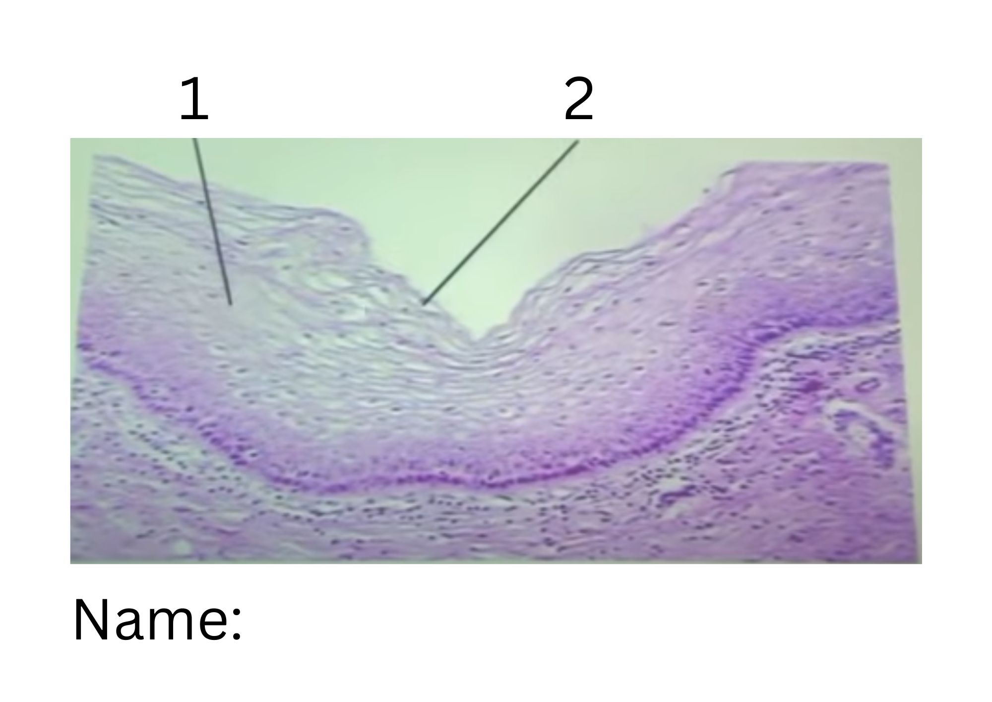 term image