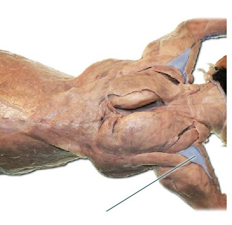 <p>below calvodeltoid, runs side to side, abduction of the arm; can contribute to flexion, extension, and rotation of the arm</p>