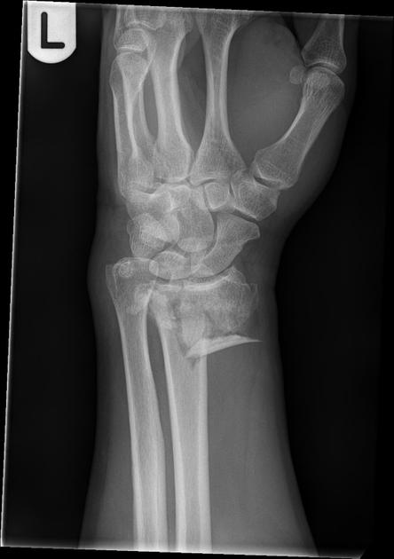 <p>Describe the abnormality demonstrated. </p>