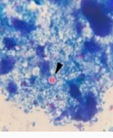 <p>Cryptosporidium suis in <span style="color: rgb(230, 155, 255)">pigs</span></p>