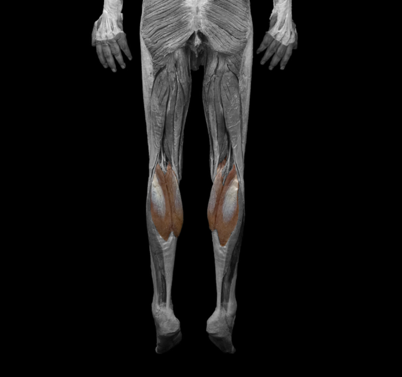 <p>origin: lateral + medial condyles of femur</p><p></p><p>insertion: calcaneus (achilles tendon) </p><p></p><p>action: plantar flex, flex leg at knee </p><p></p><p>innervation: tibial nerve </p>