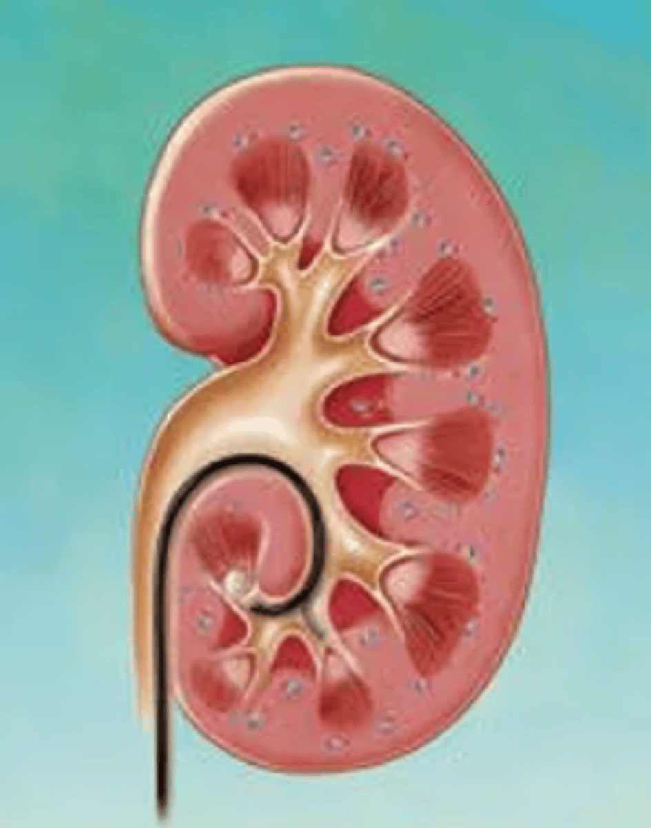 <p>Via de flexibele ureteroscoop kan men zelf tot in het pyelum visualiseren. Hier kunnen eventuele nierstenen geëvacueerd worden. Dit noemt men?</p>