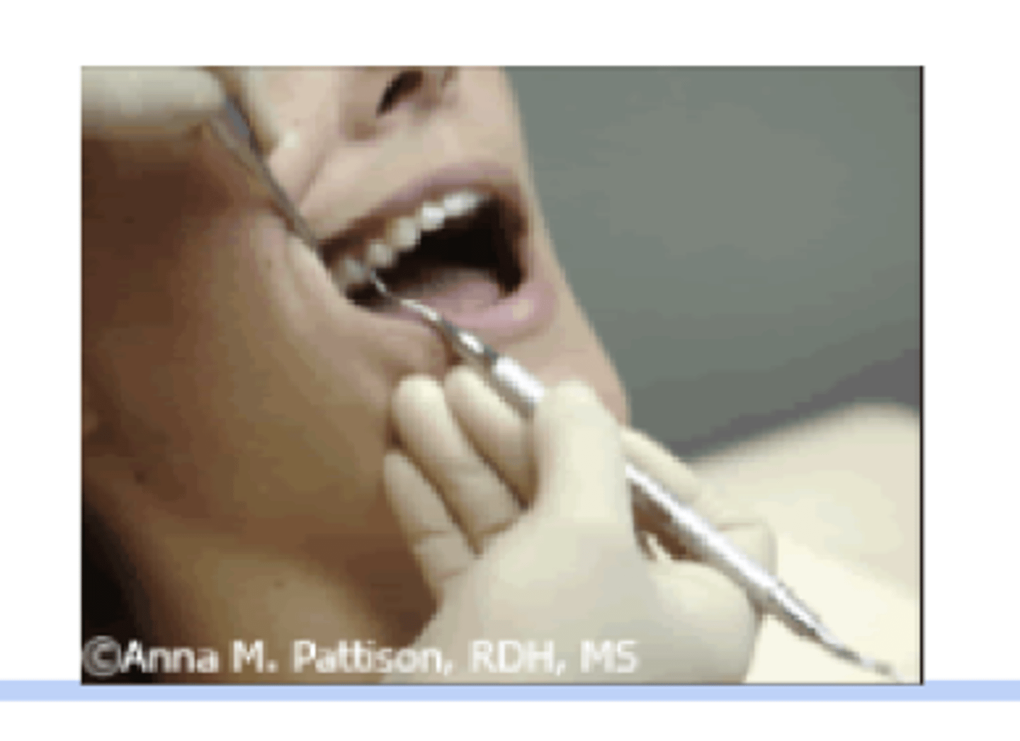 <p>palm up</p><p>fingers together and stationary</p><p>activation by shoulder</p>