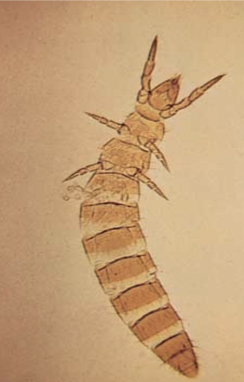 <p></p><p>• Small (2 mm or less)</p><p>• As many as 800 described species</p><p>• Lack antennae and front legs serve a</p><p>similar function (these are visible</p><p>next to head in adjacent image)</p><p>• Soil dwelling insects that feed on</p><p>fungi and decaying plant material</p>