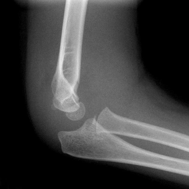 <p>Describe the abnormality demonstrated.</p>