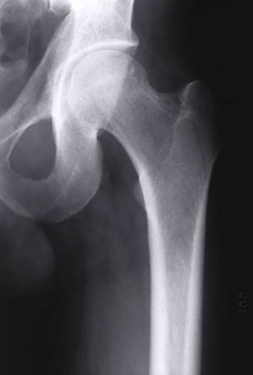 <p>AP</p><p>3 multiple choice options</p>