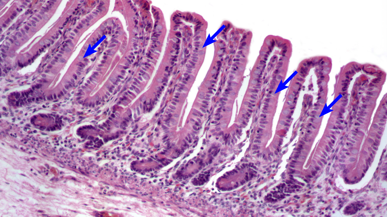 knowt flashcard image