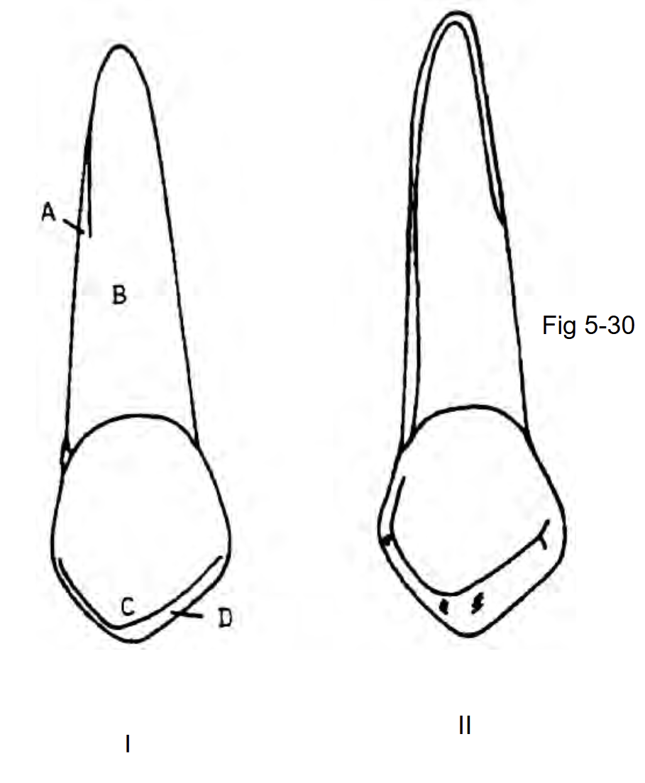 <p>Identify the teeth I and II respectively </p>