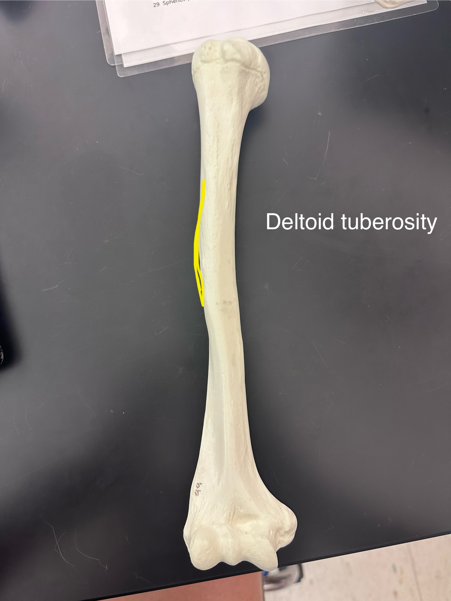 <p>Deltoid Tuberosity</p>