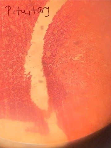 <p>Identify this slide.</p>