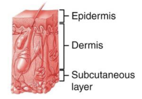 <p>Full thickness burn that destroys the epidermis, dermis, and subcutaneous layer</p>