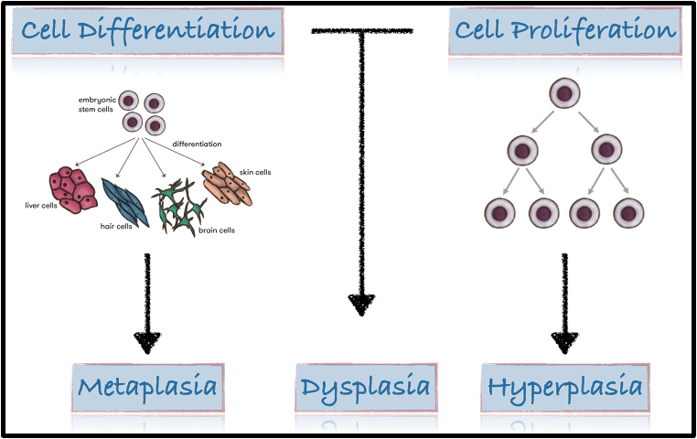 <p>outline (epithelial) dysplasia </p>