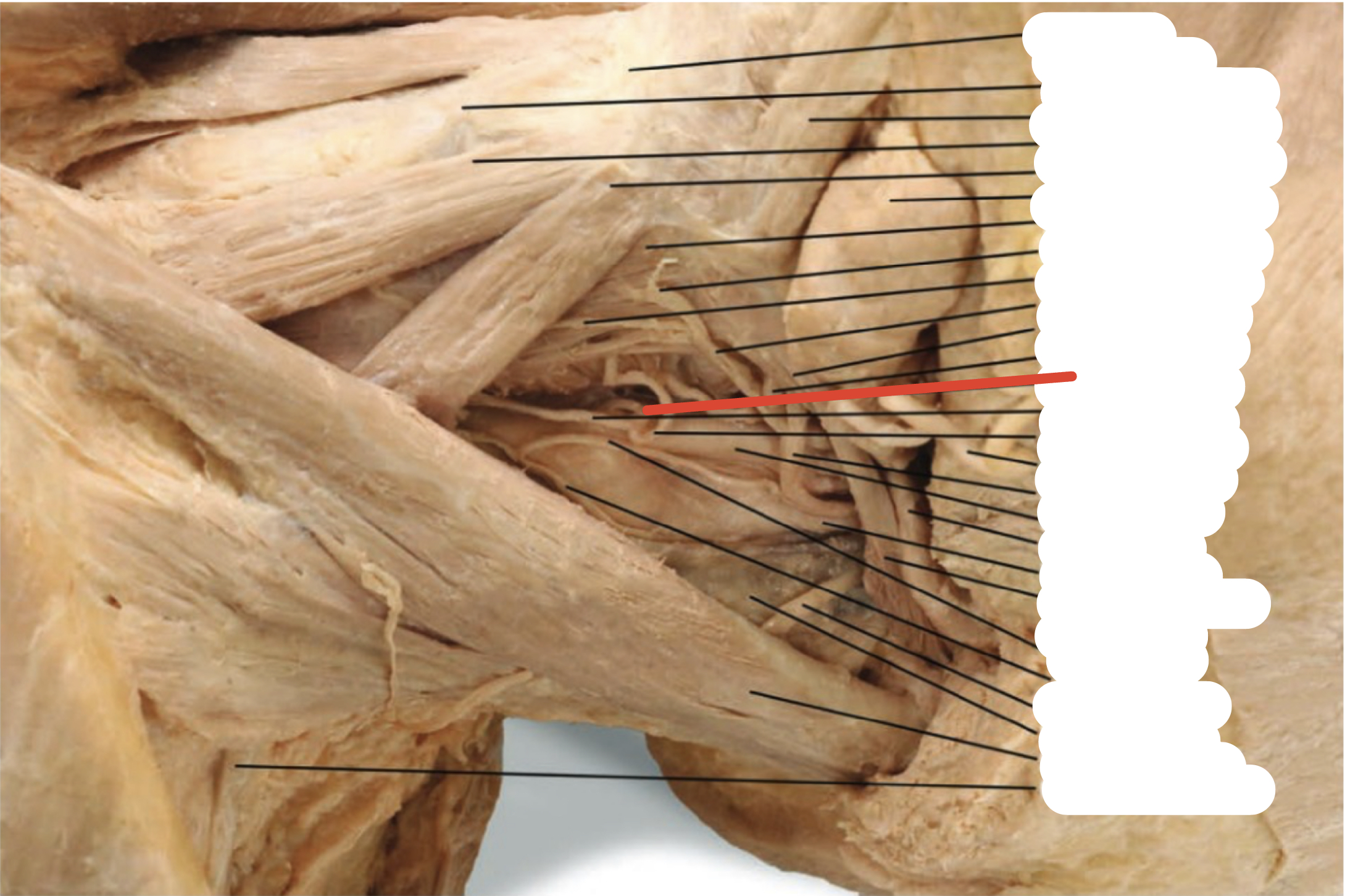Identify the structure (red line)