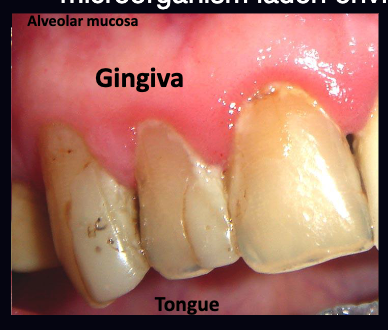 <p>shedding = gingiva, alveolar mucosa, tongue (covered with epithelium)<br>non-shedding = tooth (not covered with epithelium)</p>