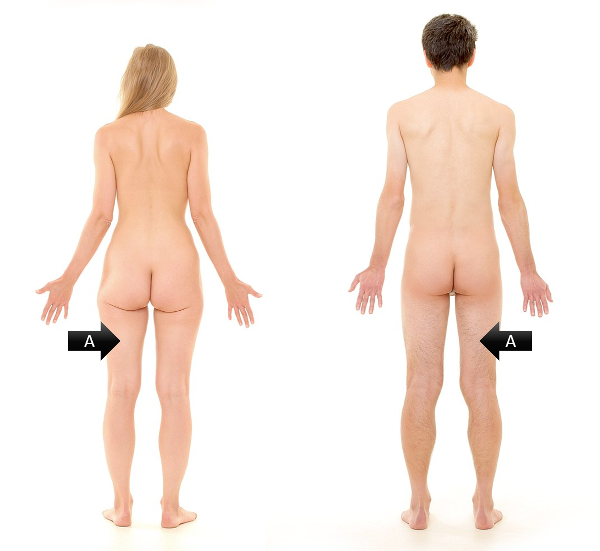 <p><span><span>Identify the gross anatomical region labeled A</span></span></p>