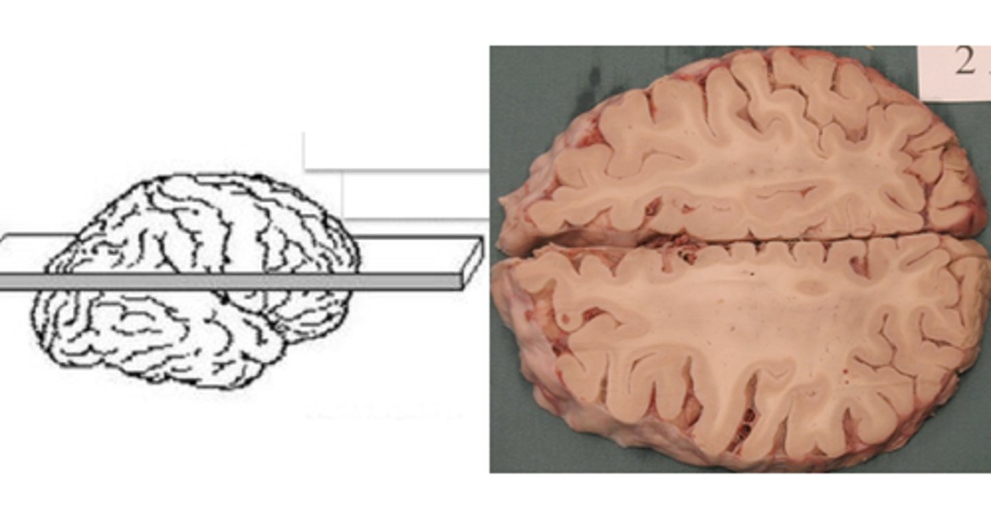 <p><strong>Axial cross-sections</strong></p>